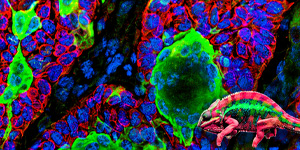 Workshop on Understanding Plasticity and its Role Across the Cancer Continuum