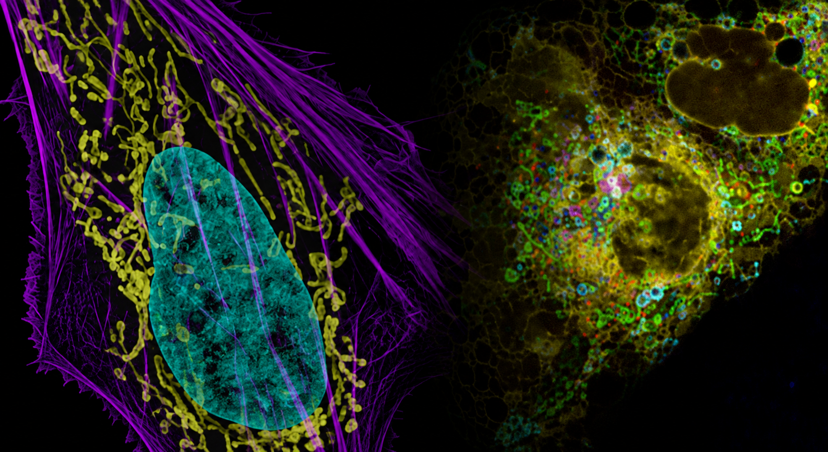 Hidden in Plain Sight (HIPS): The Role of Organelles in Cancer Biology
